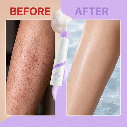 Gentle Hair Removal Cream for Sensitive Skin – Aloe & Hyaluronic Acid